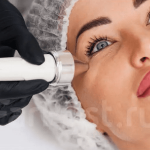 фонофорез вокруг глаз