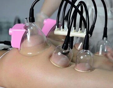 Ваккумный массаж