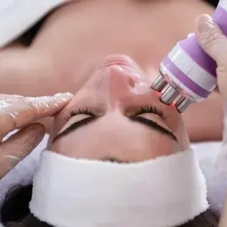 RF- лифтинг лицо, шея - 30 мин