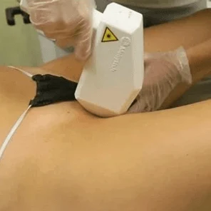 Бикини глубокое