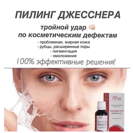 Пилинг Джеснера