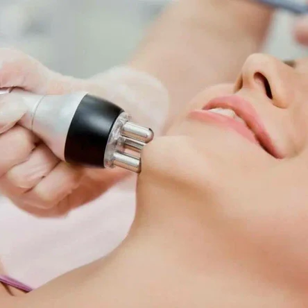 RF-лифтинг -30 мин.