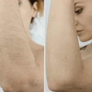 Руки до локтя