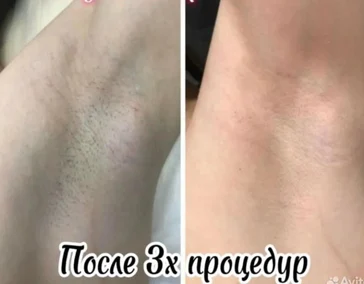 Повышение самооценки и уверенности в себе