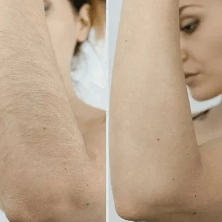 Руки до локтя