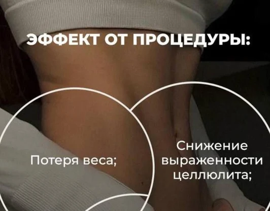 Коррекция фигуры