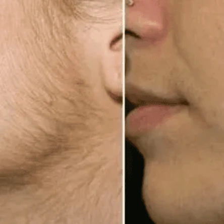 Бакенбарды