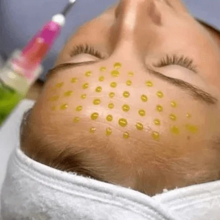 Пилинги всесезонные: молочный, азелаиновый.,миндальный, гликолевый, энзимный, белый ,зеленый двухфазный