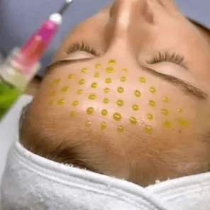 Пилинги всесезонные: молочный, азелаиновый.,миндальный, гликолевый, энзимный, белый ,зеленый двухфазный