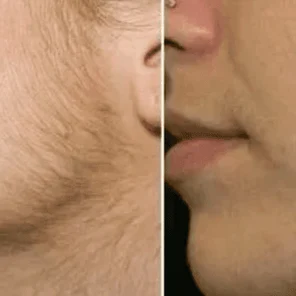 Бакенбарды